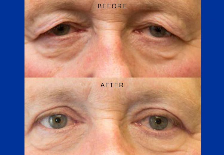 Malouf Eye Clinicss